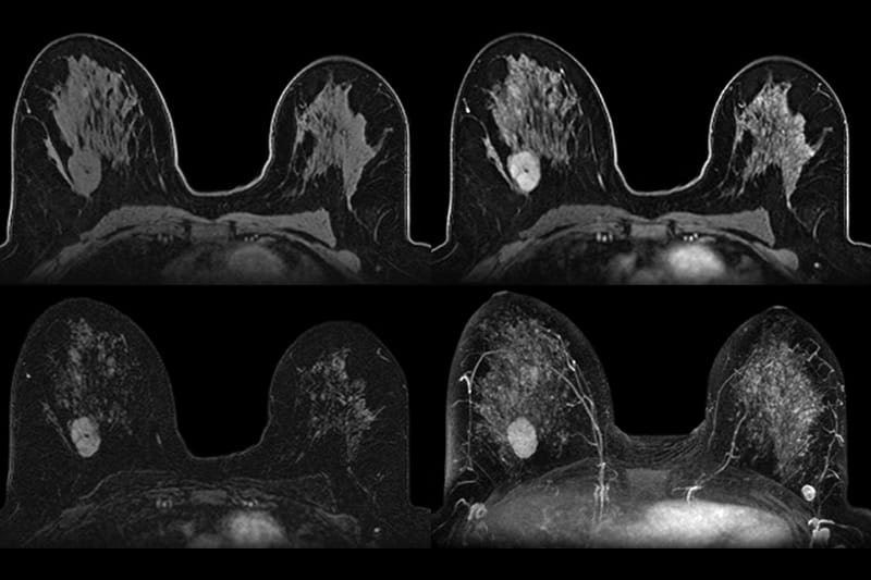 Holographic Medical Scanner