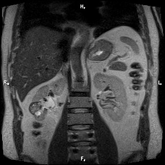 Holographic Medical Scanner